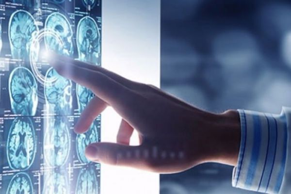 Prof. Dr. Üçler: ALS zeki insanlarda daha sık görülüyor