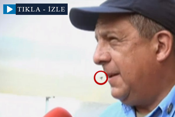 Konuşurken arıyı yuttu