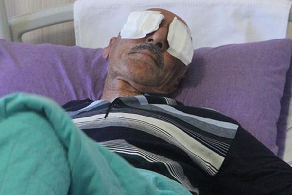 Dehşet: Kamyonet kasasında 2 gözünü oydu