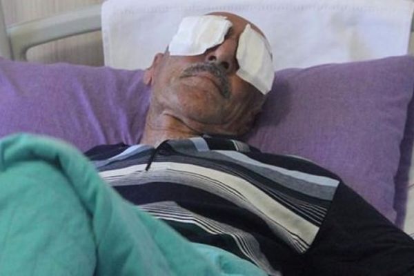 Dehşet! Kamyon kasasından çıktı, 2 gözünü oydu