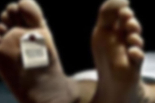 İnsan cesedi neden kokar?