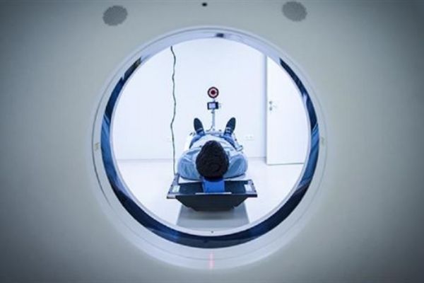 Türk bilim adamından yeni nörolojik hastalık keşfi