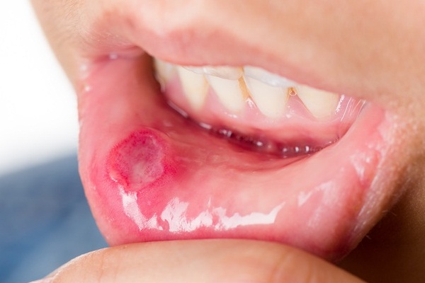 Elektronik sigara içenler dikkat