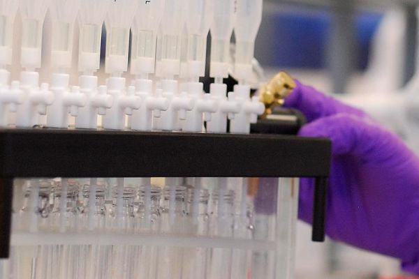 'Aç kalmak kanser riskini azaltıyor'