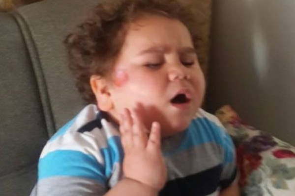 'Çitos Efe' kaza geçirdi