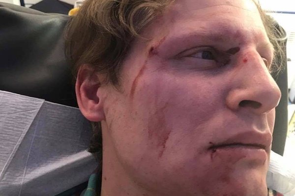 PKK yandaşları Türkiye dostu Alman gazeteciyi darp etti