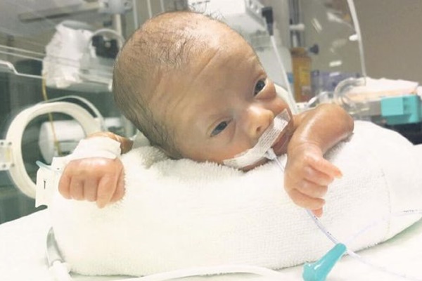600 gram doğdu hayata tutundu