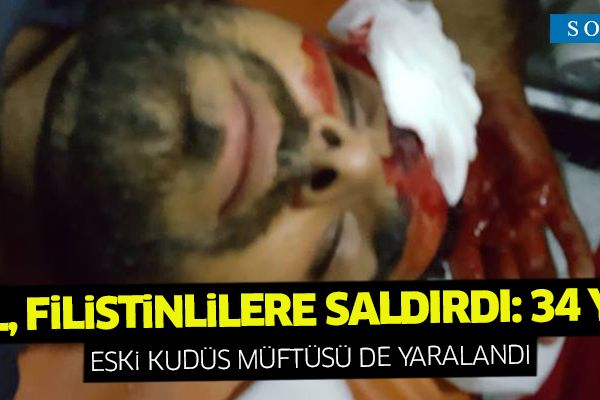 İsrail, Filistinlilere saldırdı: 34 yaralı