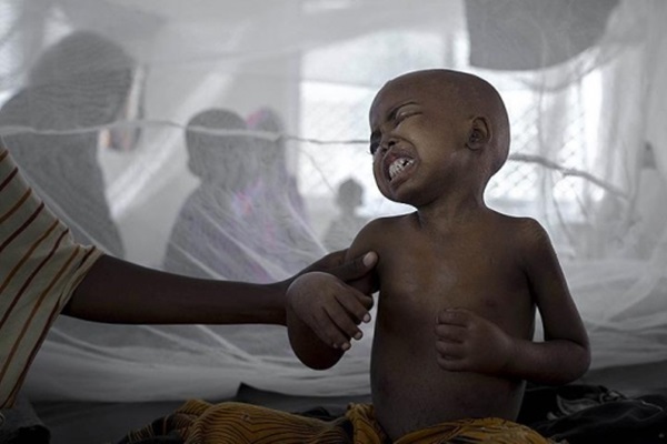 Kolera salgını 17 can aldı