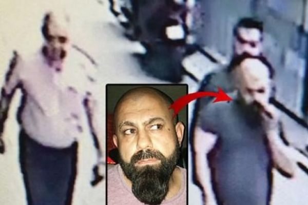 VIP saç ekimi için geldi canını zor kurtardı!