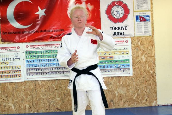 Albino hastası Cahide'nin hedefi altın madalya