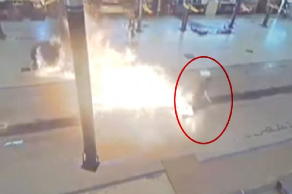 Bir anda alevlerin içinde kaldı