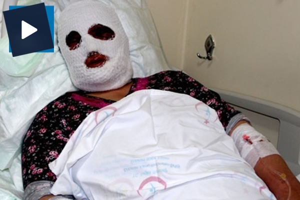 Temizlik yaparken bu hale geldi