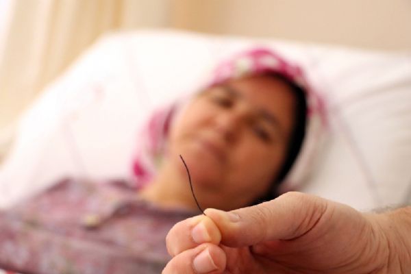Petek bal yedi, midesinden 10 santim tel çıktı
