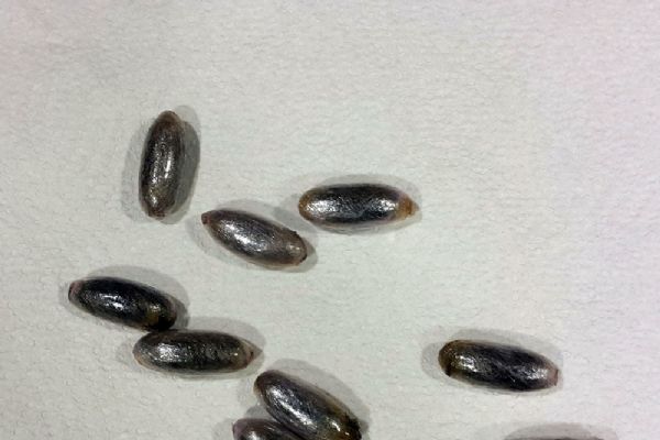 Bunlar hastanın değil bir suçlunun midesinde bulundu