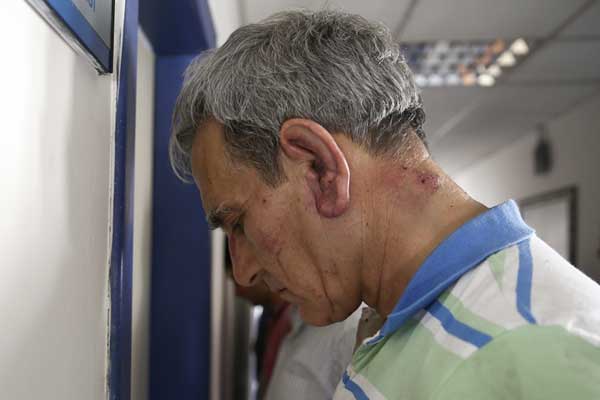 Akıncı Üssü davası bugün başlıyor