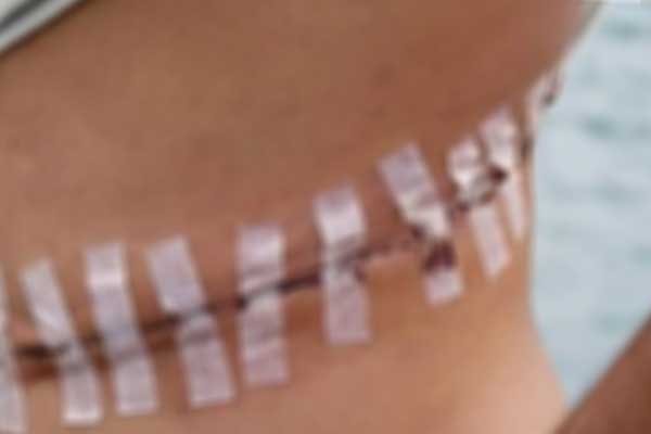 Sosyal medyada satışa çıkarılan organlara 100 bin TL istiyorlar!