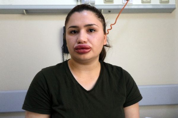 Estetik mağduru hemşireye üzücü haber