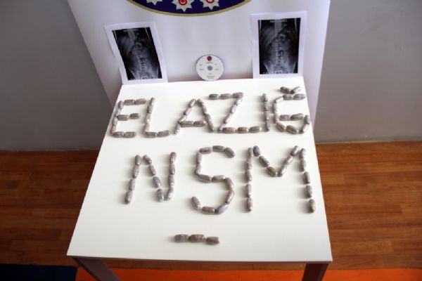 Elazığ'da İranlı kuryenin midesinden eroin çıktı