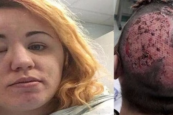 Saçının rengini değiştirmek istedi, bu hale geldi