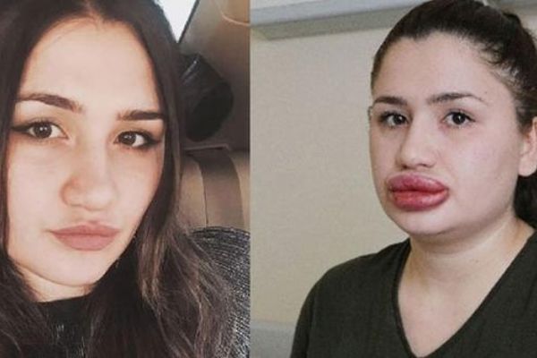 'Sahte estetikçi' cezaevinden kaçtı