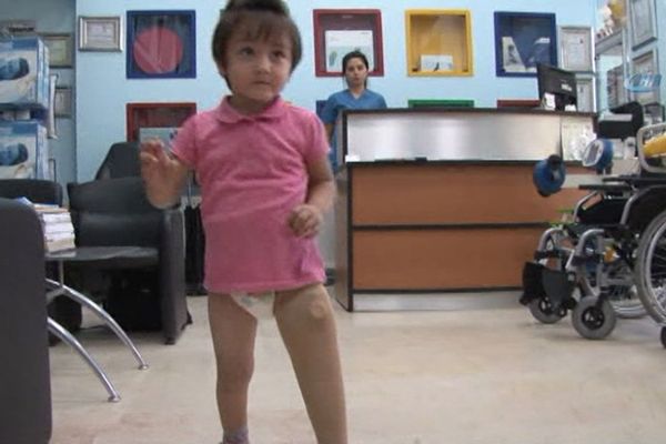 Minik Özge yeni protezine kavuştu