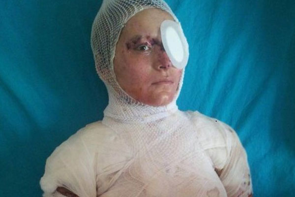 Boşanmak isteyen eşe korkunç işkence