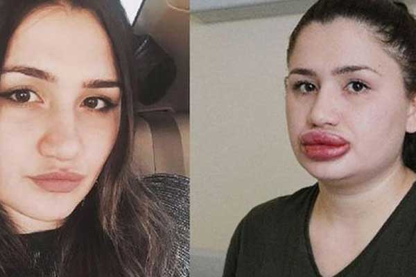 Kaçan 'sahte estetikçi' yakalandı