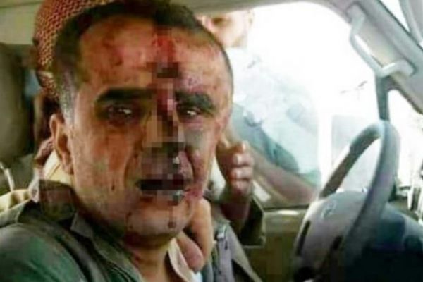 Suriye'de ÖSO, pilotu esir aldı