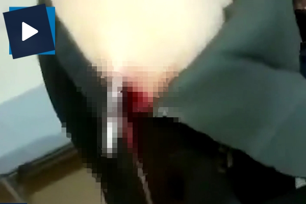 Boynuna saplanıp omzundan çıktı!