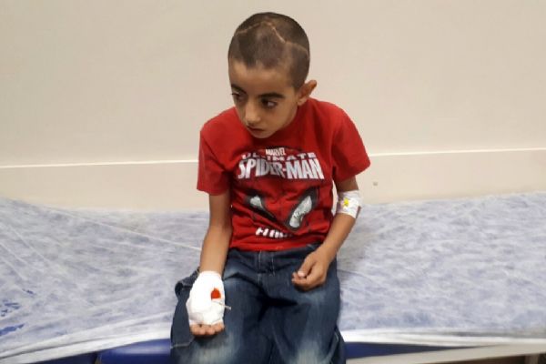 Adıyaman'da 9 yaşındaki çocuğun eline şiş saplandı