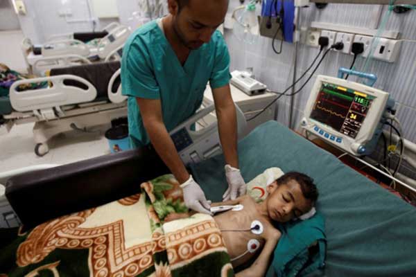 Yemen'deki kolera salgını 12 bin can aldı