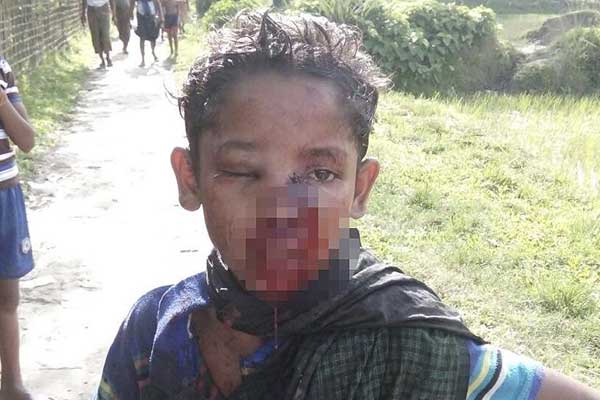 İHAK'tan Arakan çağrısı