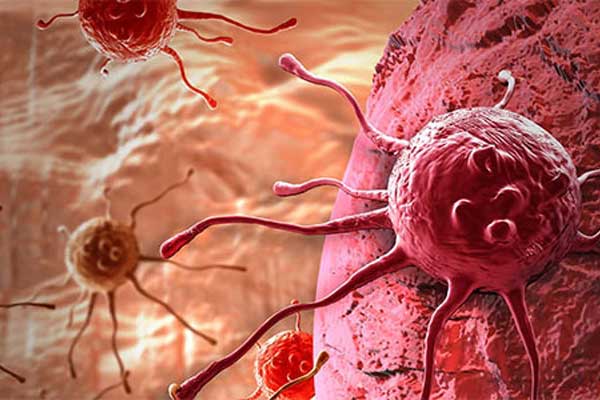 Kanser tedavisinde yeni yöntem