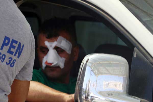 Bayramın ilk günü 3 bin 102 acemi kasap hastanelik oldu