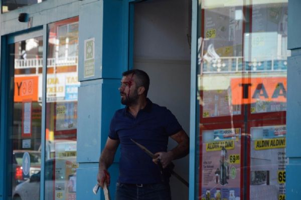 Tokat'ta taşlı, sopalı kavga: 11 yaralı