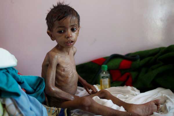 Yemen'de 10 milyon çocuğun yardıma muhtaç