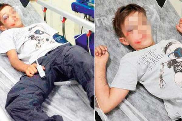 Kendisine çarptı diye çocuğu beton zemine fırlattı!