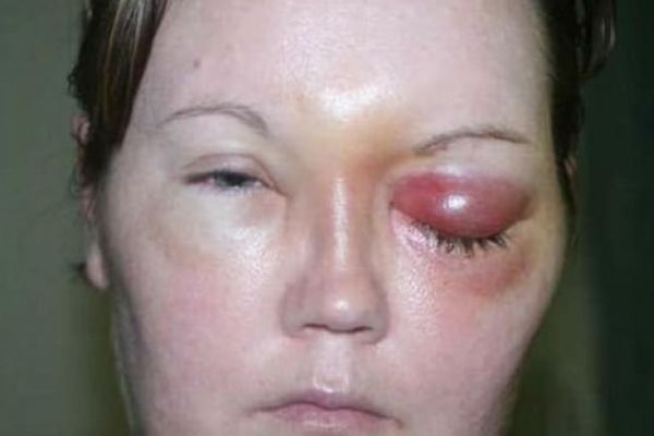 Genç kadın gün ışığına bile çıkamıyor!