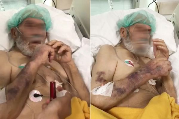 Sakarya'da yoğum bakım hastasına sigara verip dalga geçtiler