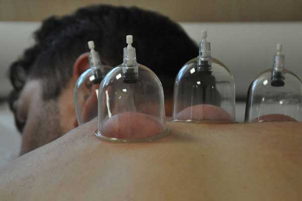 Kamuda sülük ve hacamat eğitimi