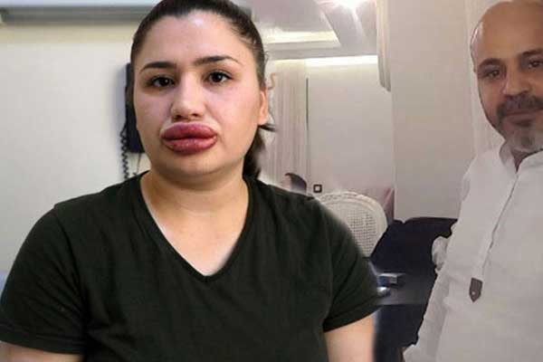 Sahte estetikçinin ne enjekte ettiği ortaya çıktı