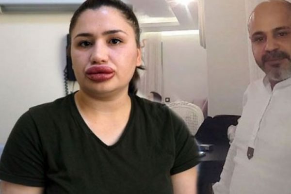 Adana'da sahte estetikçi inşaat silikonu enjekte etmiş