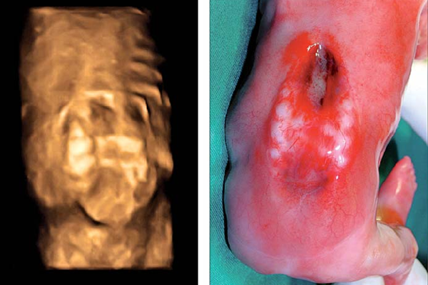 Gebelikten önce bu konuda önlem alın