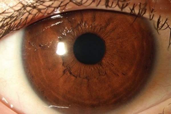 Bu vitaminin eksikliği kör edebilir