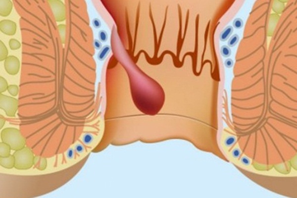 Bu belirtiler varsa dikkat!