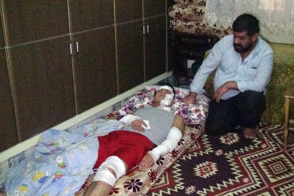 Gaziantep'te evde oynadığı havai fişek elinde patladı