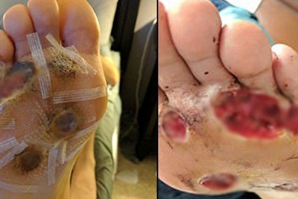 Çıplak ayakla duş aldı, bedeli ağır oldu