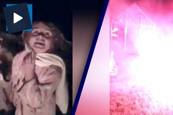 Havai fişek çocuğa küçük isabet etti