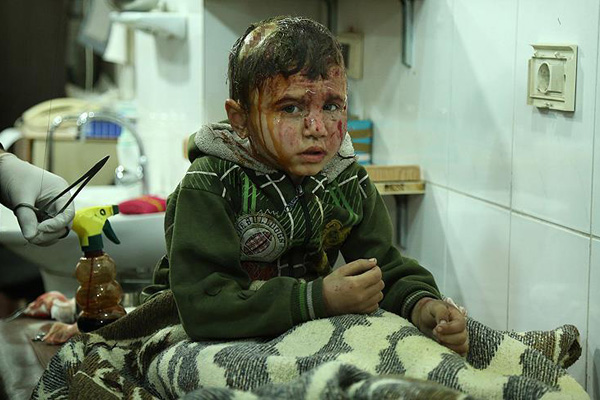 Esed güçleri yine sivilleri hedef aldı